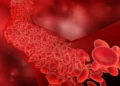 Colesterol, un factor silencioso que impacta la salud cardiovascular